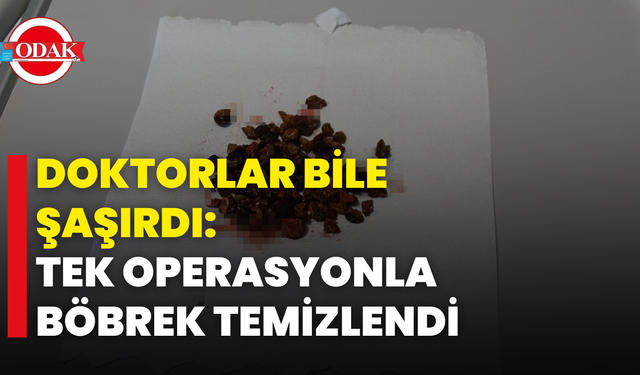 Doktorlar Bile Şaşırdı: Tek Operasyonla Böbrek Temizlendi