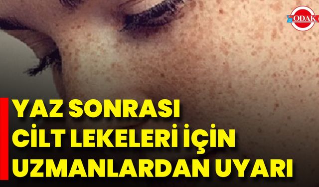 Yaz Sonrası Cilt Lekeleri İçin Uzmanlardan Uyarı
