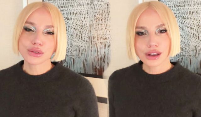 Gülşen’in Yüzündeki Değişim Sosyal Medyada Gündem Oldu