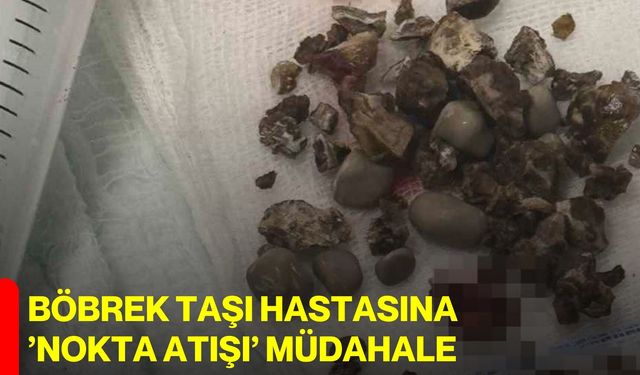 Böbrek taşı hastasına ’nokta atışı’ müdahale