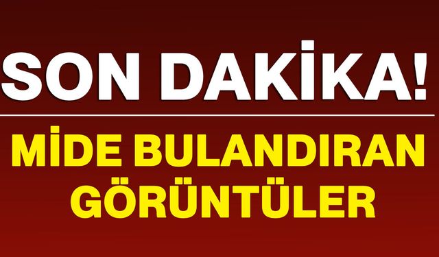 Mide bulandıran görüntüler