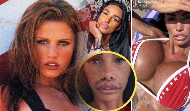 Katie Price 43 estetik operasyon sonrası gündem oldu