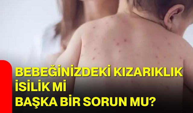 Bebeğinizdeki kızarıklık isilik mi, başka bir sorun mu?
