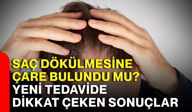 Saç dökülmesine çare bulundu mu? Yeni tedavide dikkat çeken sonuçlar