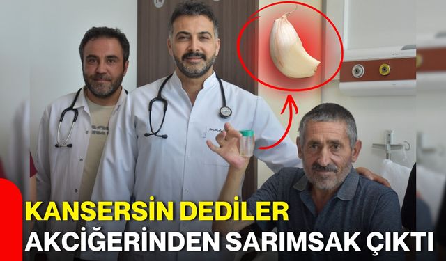 Kansersin dediler akciğerinden sarımsak çıktı