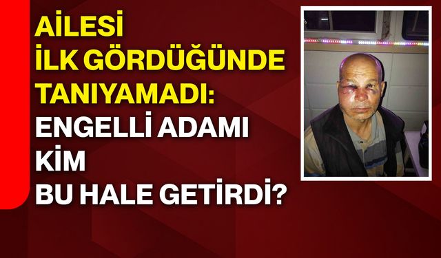 Ailesi ilk gördüğünde tanıyamadı: Engelli adamı kim bu hale getirdi?