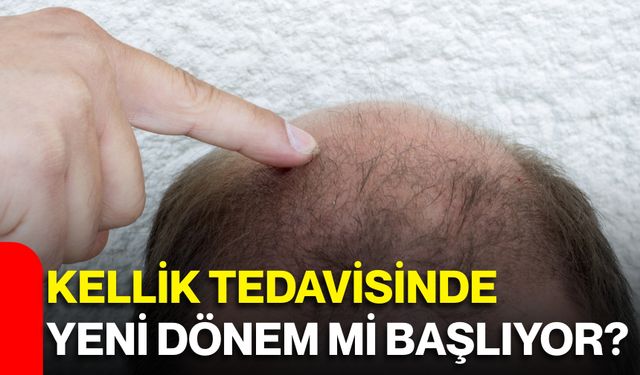 Kellik tedavisinde yeni dönem mi başlıyor?