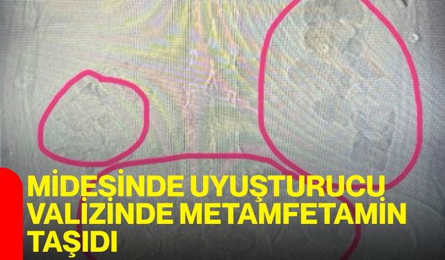 Midesinde uyuşturucu, valizinde metamfetamin taşıdı