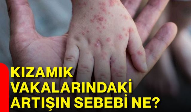 Kızamık vakalarındaki artışın sebebi ne?