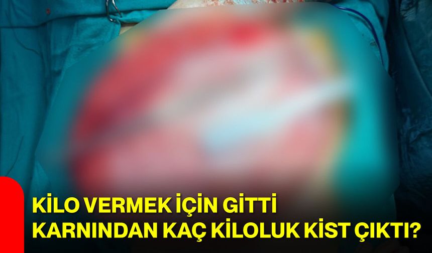 Kilo Vermek İçin Gitti, Karnından Kaç Kiloluk Kist Çıktı?