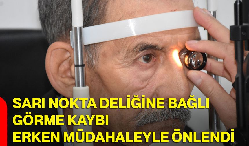 Sarı nokta deliğine bağlı görme kaybı erken müdahaleyle önlendi