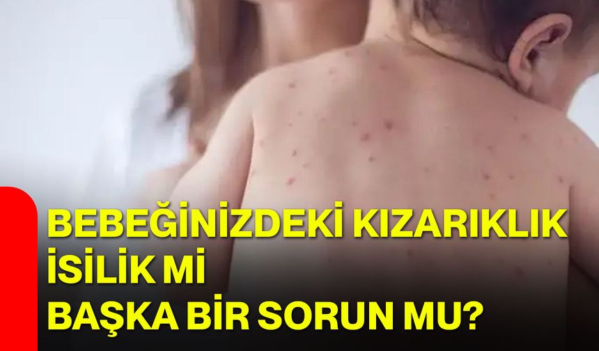 Bebeğinizdeki kızarıklık isilik mi, başka bir sorun mu?