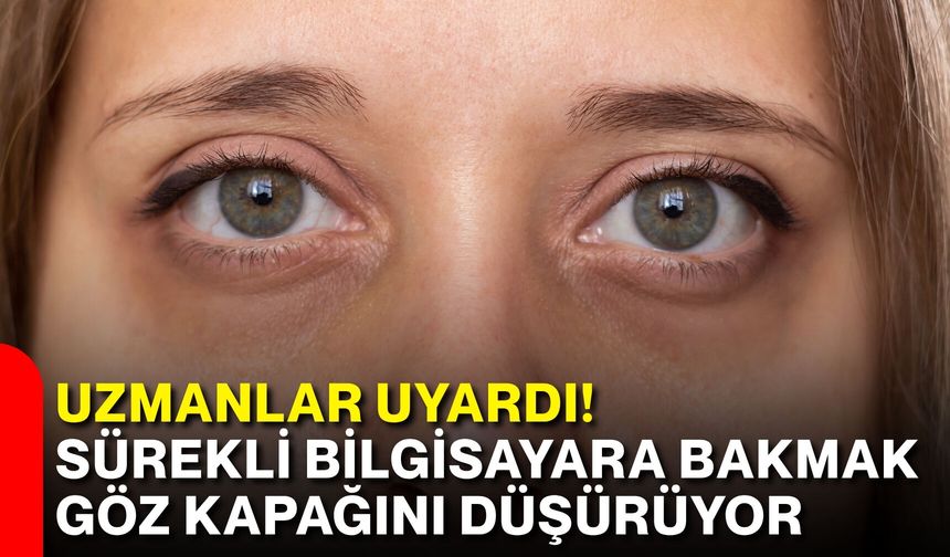 Uzmanlar uyardı! Sürekli bilgisayara bakmak göz kapağını düşürüyor