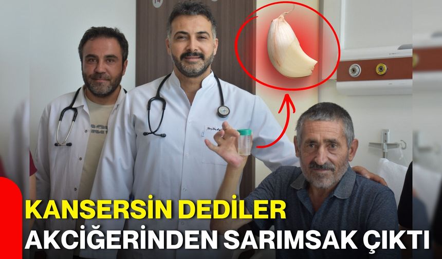 Kansersin dediler akciğerinden sarımsak çıktı
