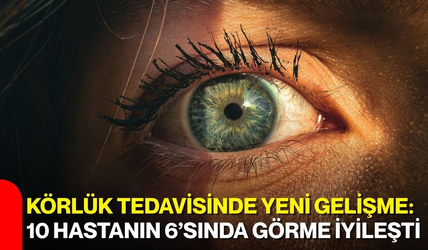 Körlük tedavisinde yeni gelişme: 10 hastanın 6’sında görme iyileşti