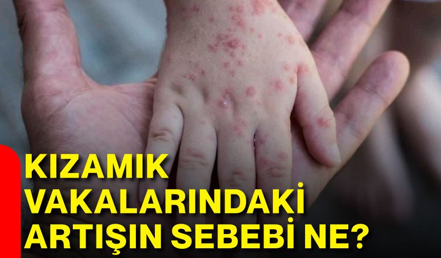 Kızamık vakalarındaki artışın sebebi ne?