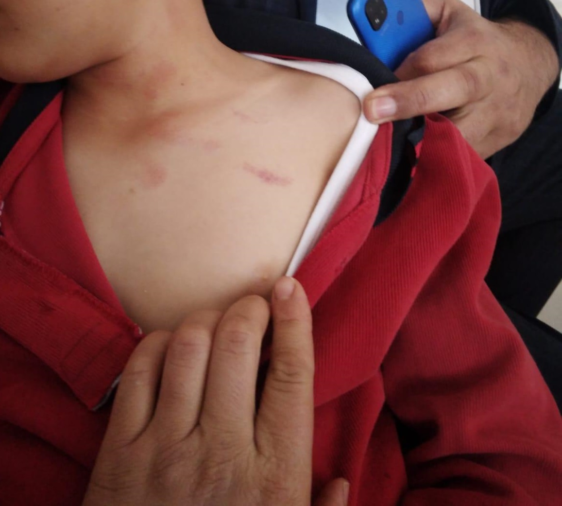 Afyon'da dövülen çocuk fotoğrafı