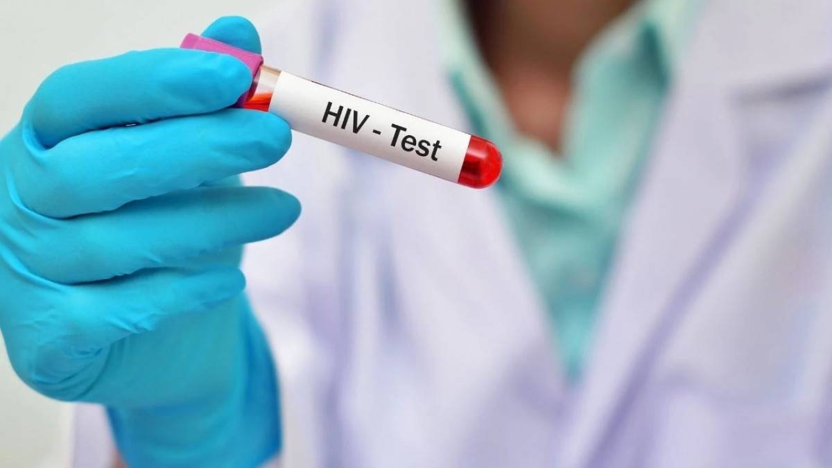 Hiv İle Mücadelede Erken Tani Vurgusu “Aids Artik Kroni̇k Bi̇r Hastalik” (2)