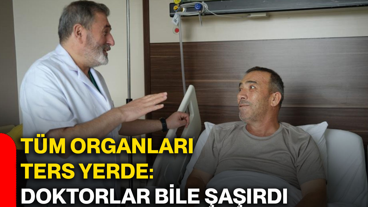 Tüm organları ters yerde: Doktorlar bile şaşırdı