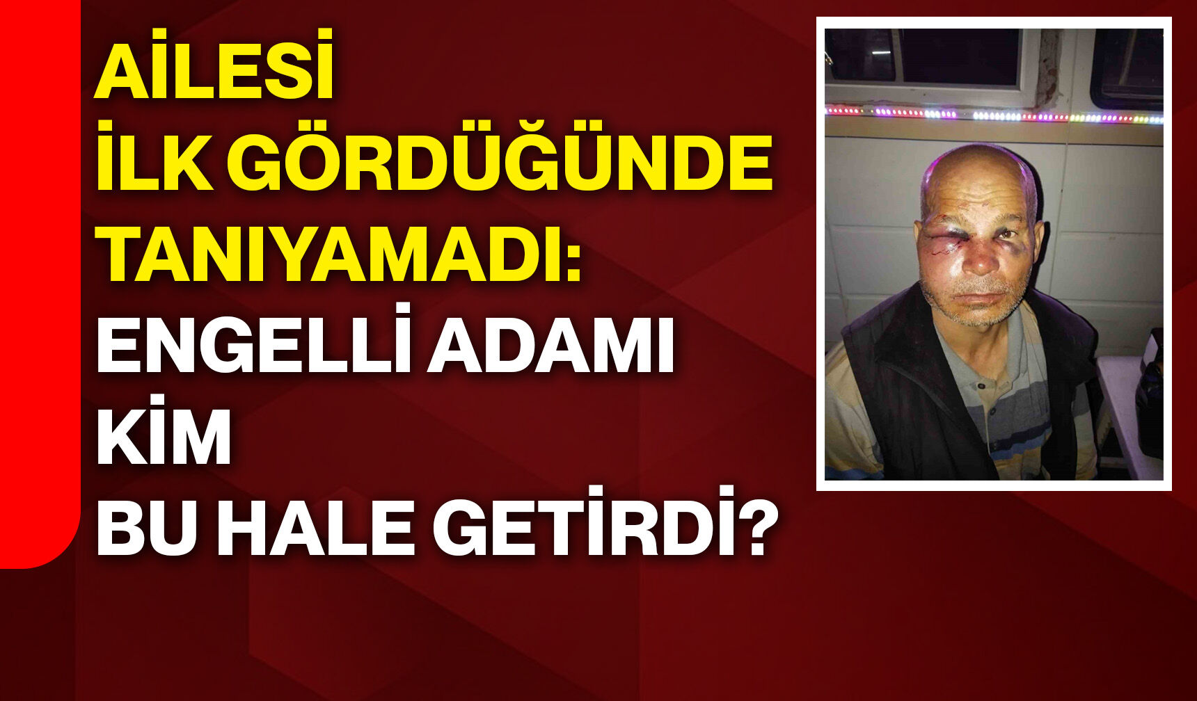 Ailesi ilk gördüğünde tanıyamadı: Engelli adamı kim bu hale getirdi?