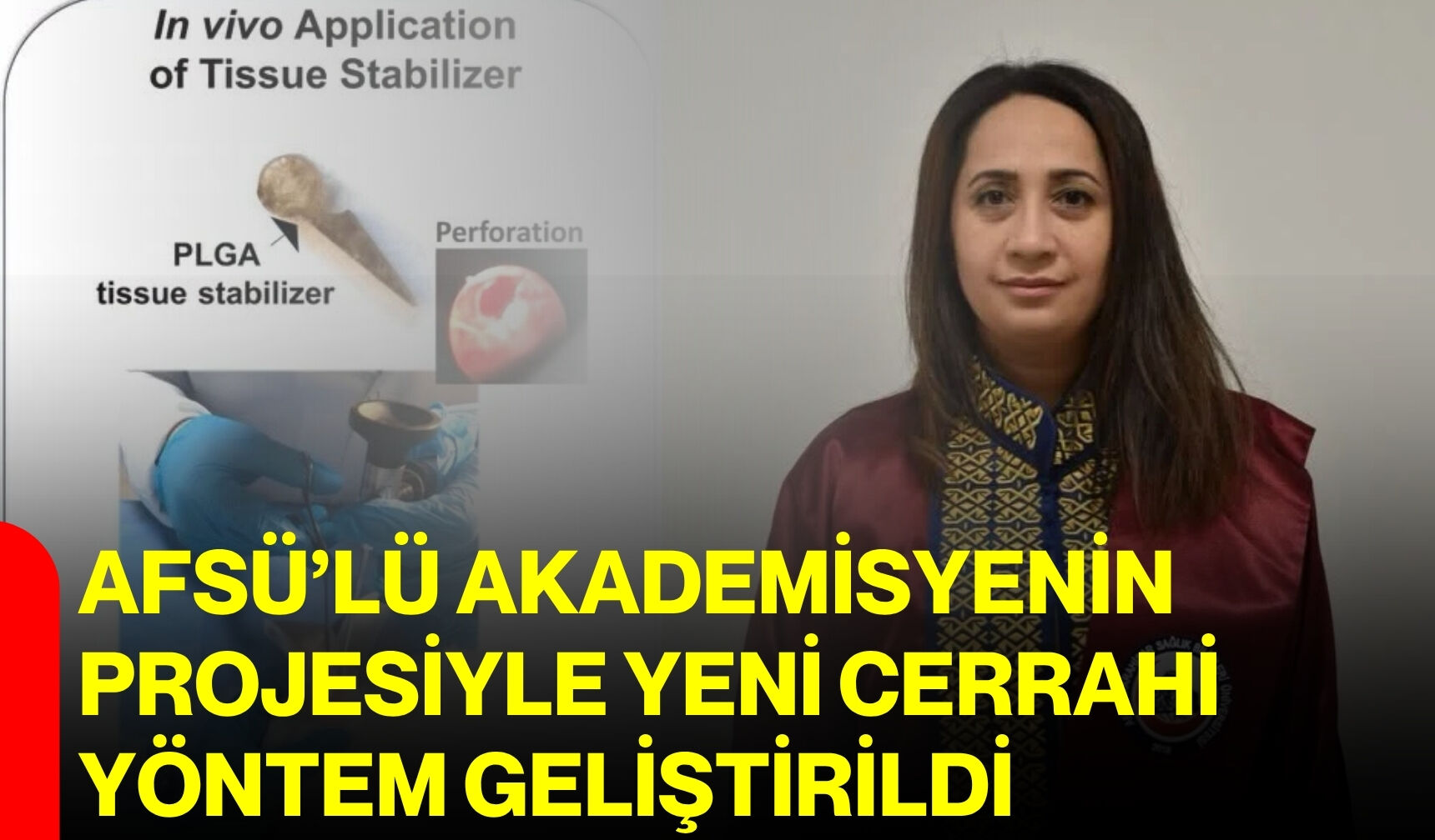 AFSÜ’lü akademisyenin projesiyle yeni cerrahi yöntem geliştirildi